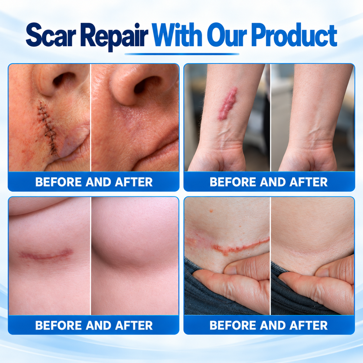Dr.Fachmer® 💡Bio-Regenerative Micro-Needle Scar Removal Patch –Repair Protein Silicone Scar Care