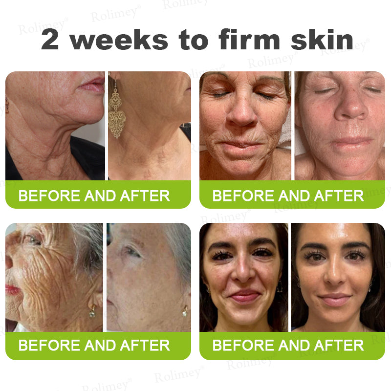 🇦🇺Made and shipped from Australia 🤍Rolimey® Botox & Vita-A Retinol Shot Wrinkle-Lift Tightening cream - Last Day Promotion 70% OFF