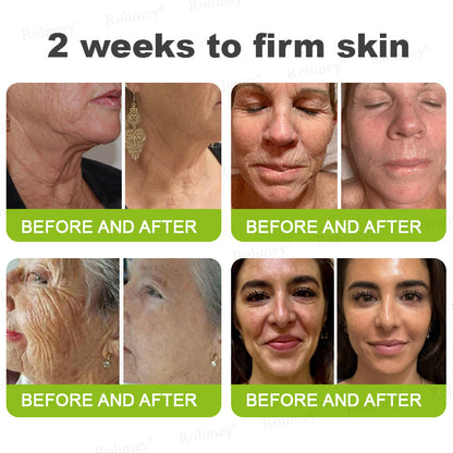🇦🇺Made and shipped from Australia 🤍Rolimey® Botox & Vita-A Retinol Shot Wrinkle-Lift Tightening cream - Last Day Promotion 70% OFF