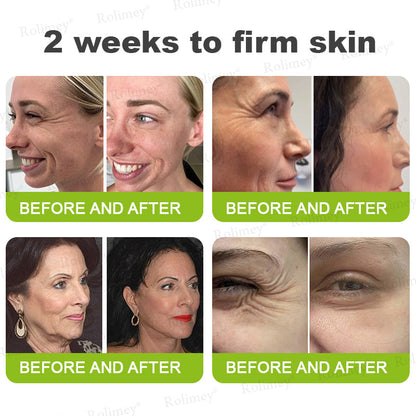 🇦🇺Made and shipped from Australia 🤍Rolimey® Botox & Vita-A Retinol Shot Wrinkle-Lift Tightening cream - Last Day Promotion 70% OFF
