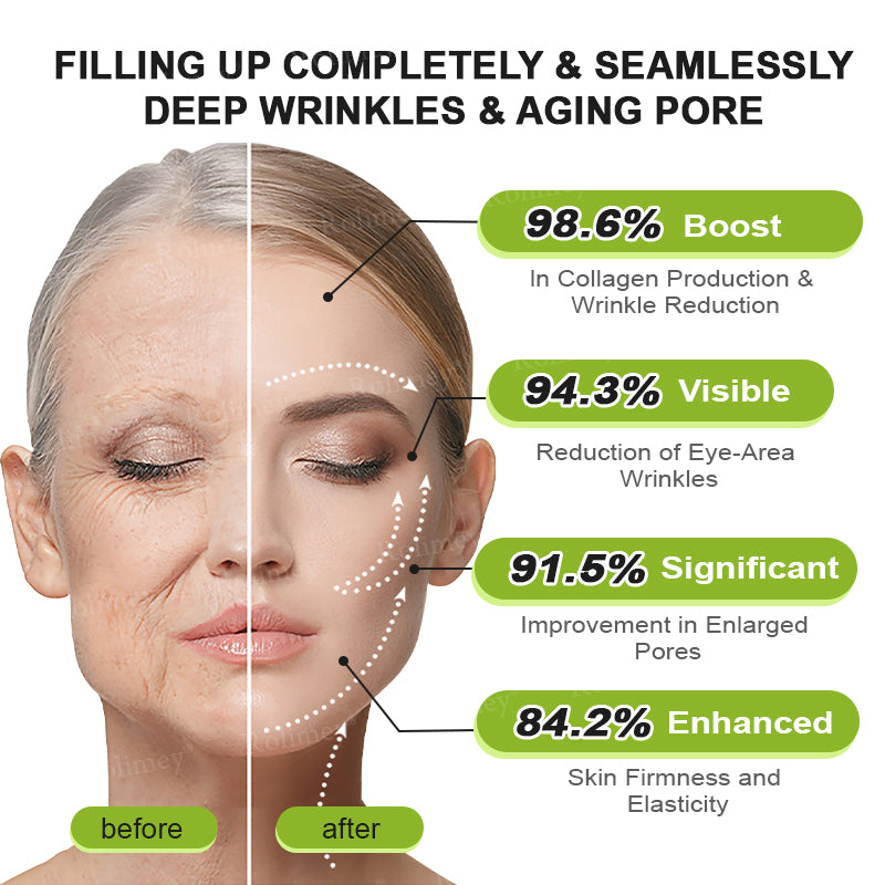 🇦🇺Made and shipped from Australia 🤍Rolimey® Botox & Vita-A Retinol Shot Wrinkle-Lift Tightening cream - Last Day Promotion 70% OFF