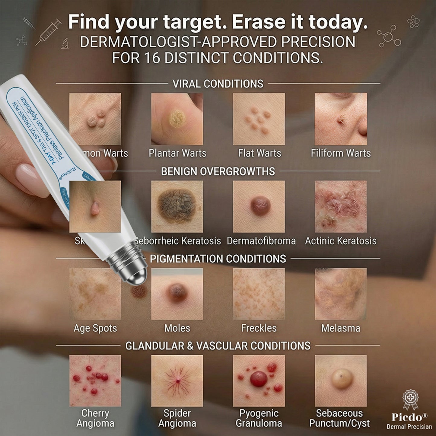 🍇Rolimey® 7-Day Roll-On for Skin Spots and Skin Tags – Pain-Free & Scar-Free