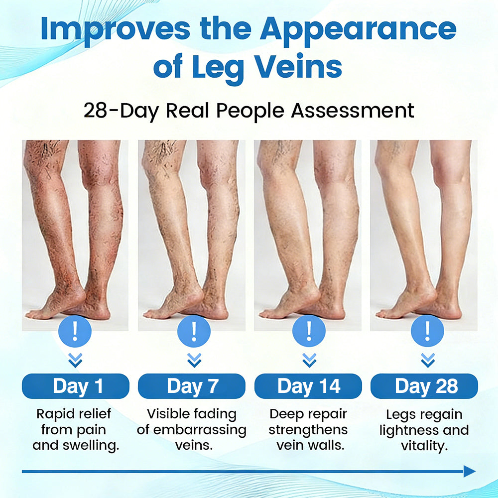 🇦🇺⌛✅🌿𝙂𝙁𝙊𝙐𝙆® VEINRX Healing Spray (Designed for Varicose veins, Spider veins, Deep vein Thrombosis, Chronic venous insufficiency, Venous ulcers, Thrombophlebitis and other venous issues)
