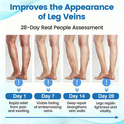 🇦🇺⌛✅🌿𝙂𝙁𝙊𝙐𝙆® VEINRX Healing Spray (Designed for Varicose veins, Spider veins, Deep vein Thrombosis, Chronic venous insufficiency, Venous ulcers, Thrombophlebitis and other venous issues)