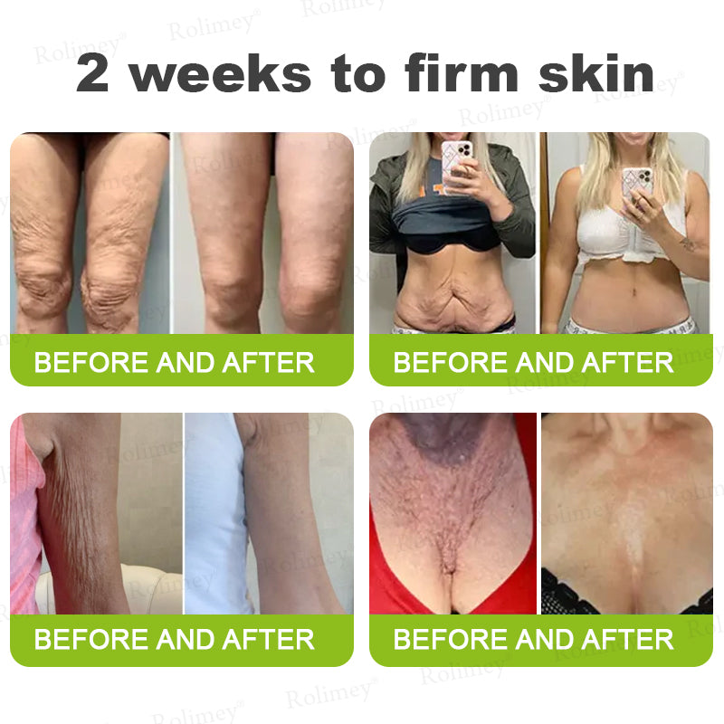 🇦🇺Made and shipped from Australia 🤍Rolimey® Botox & Vita-A Retinol Shot Wrinkle-Lift Tightening cream - Last Day Promotion 70% OFF