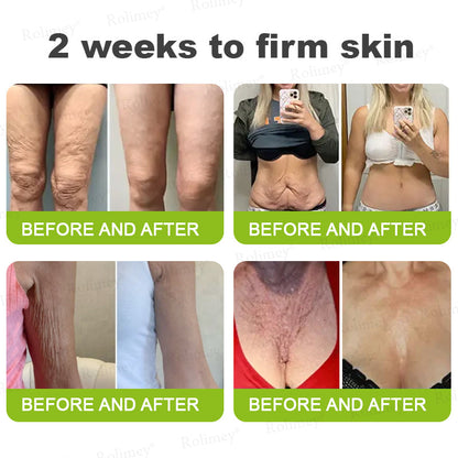 🇦🇺Made and shipped from Australia 🤍Rolimey® Botox & Vita-A Retinol Shot Wrinkle-Lift Tightening cream - Last Day Promotion 70% OFF