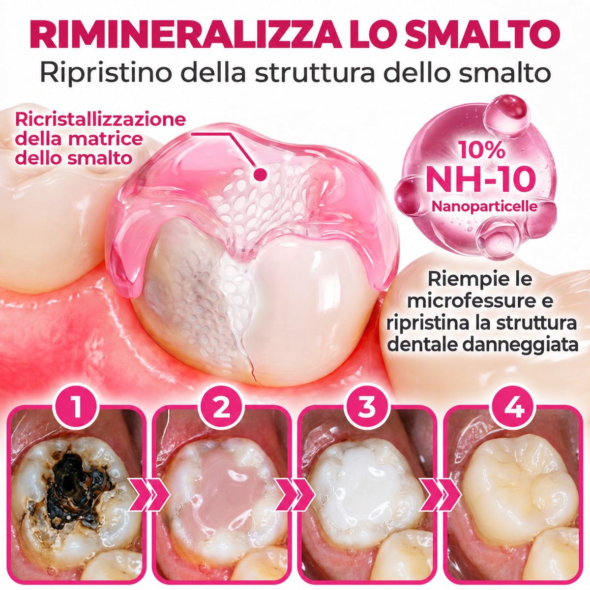 🧑‍⚕️ Rolimey® DenPerm – Gel remineralizzante per smalto e carie