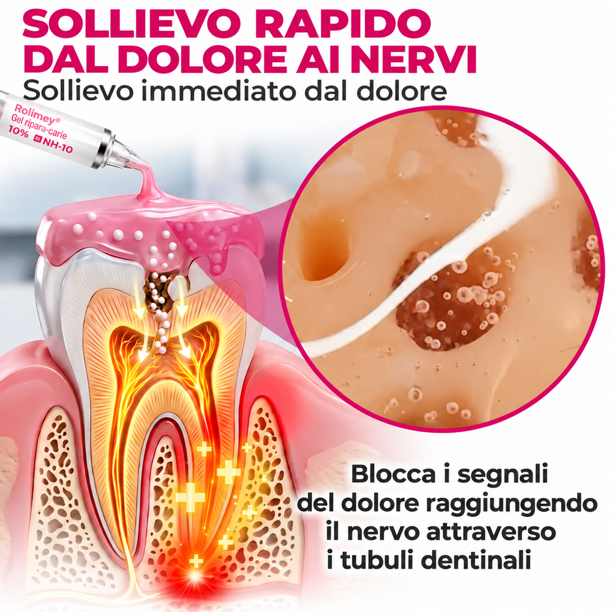 🧑‍⚕️ Rolimey® DenPerm – Gel remineralizzante per smalto e carie