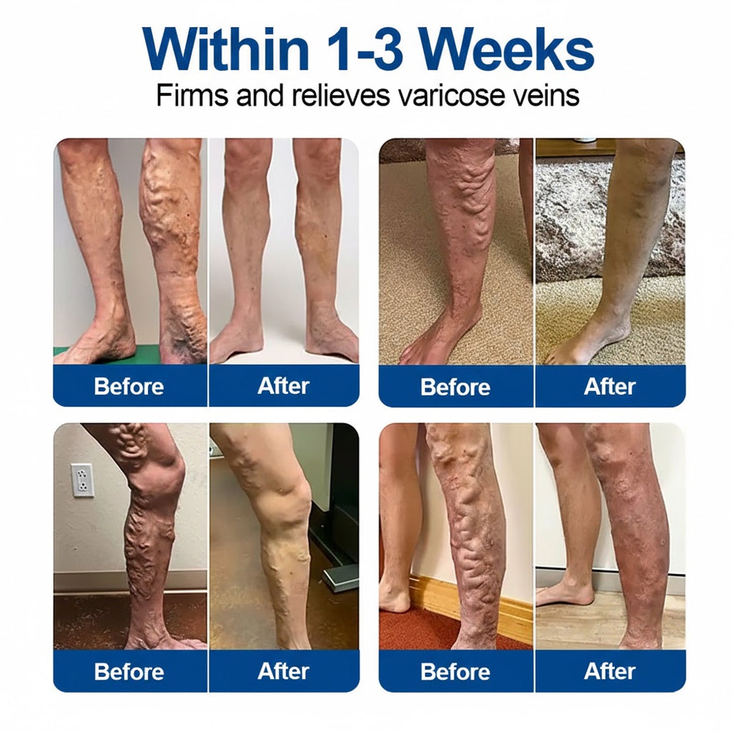 🇦🇺🩹✅GFOUK® VeinTarget Microneedle Patch⚡Instant Relief, Long-Term Results