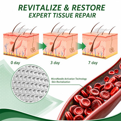 🇦🇺🩵✅DR.Fachmer® Vein Ease Microneedle Care Patch(For Spider Veins, Varicose Veins, Swelling & Leg Fatigue) - Last Day Promotion 50% OFF