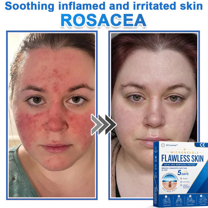 ✅ DR.Fachmer® 2-in-1 Microneedle & Hydrocolloid Patch | Raised Moles,Acne,  Flat Warts & Skin Tags Remover | Improves Wrinkles, Scars & Blemishes | Invisible Pimple Patches for Face & Body
