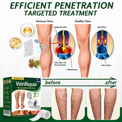 🇦🇺🩵✅DR.Fachmer® Vein Ease Microneedle Care Patch(For Spider Veins, Varicose Veins, Swelling & Leg Fatigue) - Last Day Promotion 50% OFF